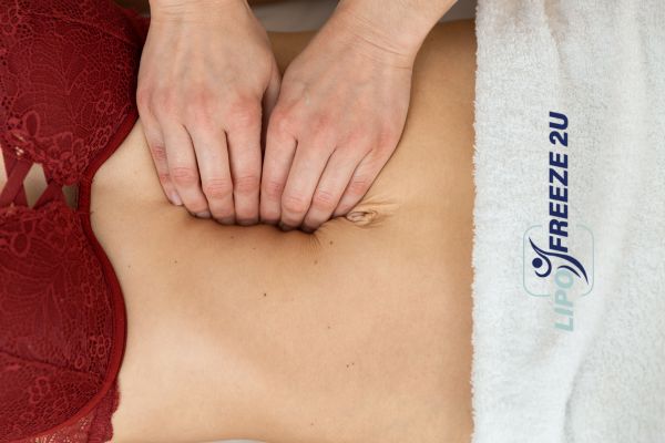 diastasis recti treatment Stourport-on-Severn