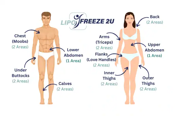 Areas you can have fat freezing treatment Stourport-on-Severn