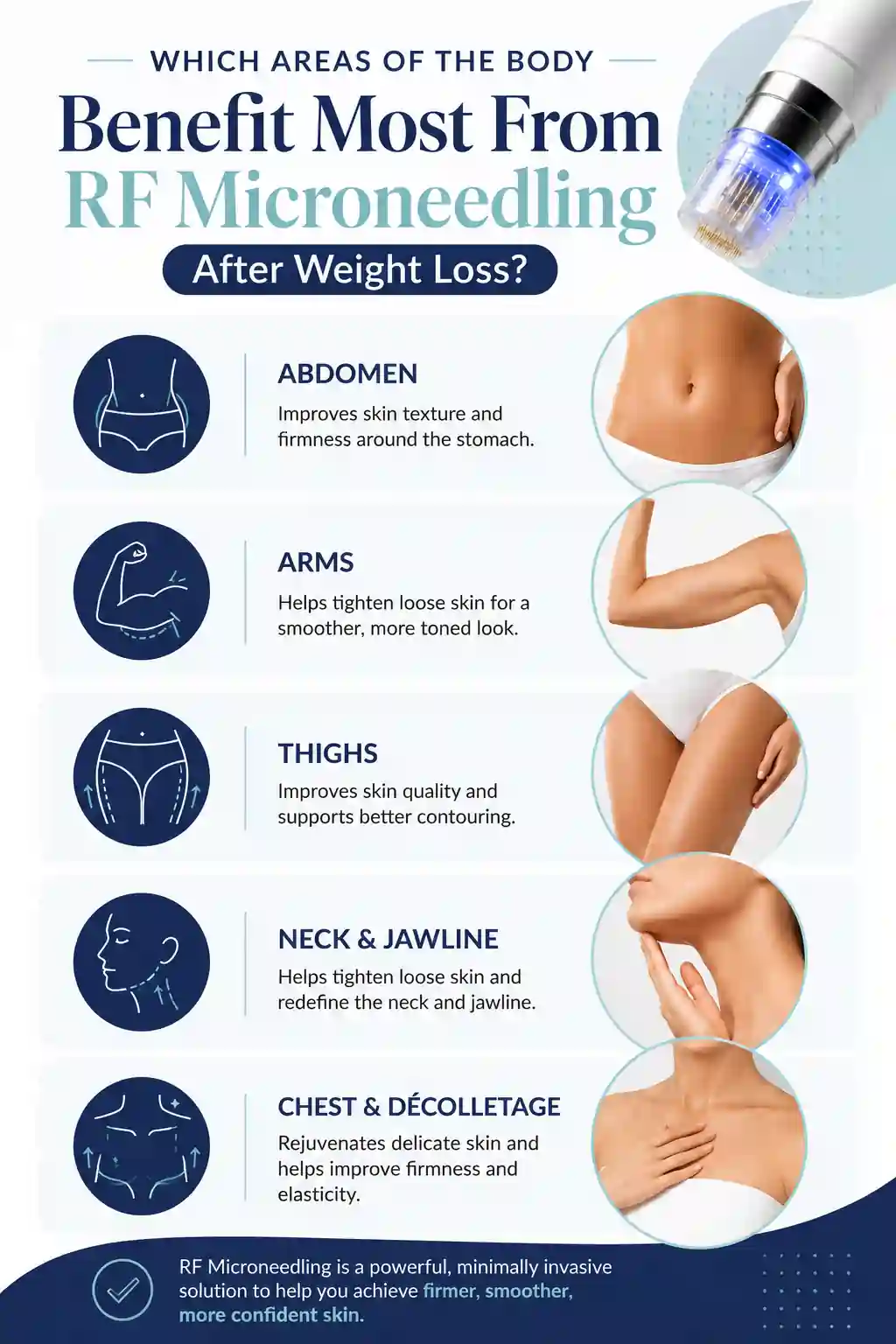 Which Areas of the Body Benefit Most From RF Microneedling After Weight Loss Stourport-on-Severn